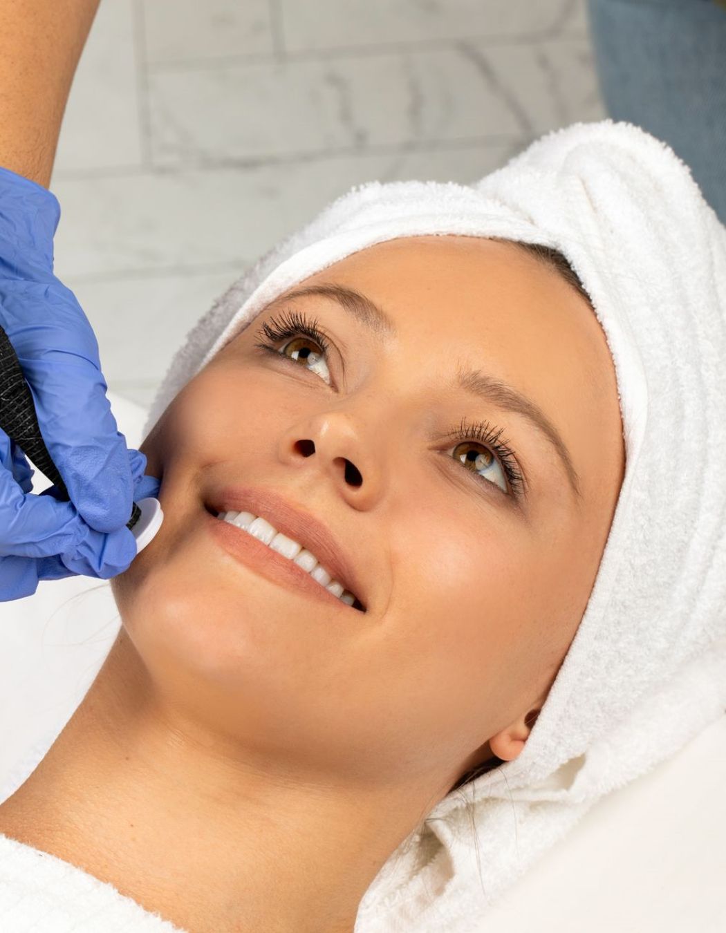 A licensed esthetician performing a microchanneling treatment at RonnaSkin.